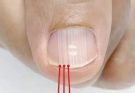 If you have these lines on your nails after 40, it is a clear sign that..