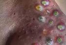 It’s absolutely possible to reduce this problem if you pick the right treatment and do some basic cleaning procedures.