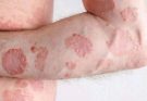 These are the consequences of sleeping with the…See more