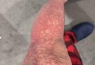 These are the consequences of sleeping with…See more